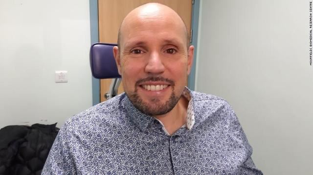 British man installs world's first 3D printed prosthetic eye